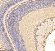 Zebrafish Psmc1 Antibody Eye Tissue IHC. Immunohistochemistry staining of FFPE zebrafish eye tissue with Psmc1 antibody, HRP-labeled secondary and DAB substrate. HIER: boil tissue sections in pH8 EDTA for 20 min and allow to cool before testing.