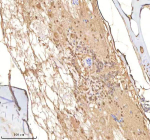 Zebrafish Psmc1 Antibody Spinal Tissue IHC. Immunohistochemistry staining of FFPE zebrafish spinal tissue with Psmc1 antibody, HRP-labeled secondary and DAB substrate. HIER: boil tissue sections in pH8 EDTA for 20 min and allow to cool before testing.