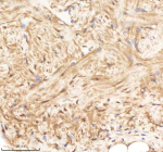 Zebrafish Psmc1 Antibody Heart Tissue IHC. Immunohistochemistry staining of FFPE zebrafish heart tissue with Psmc1 antibody, HRP-labeled secondary and DAB substrate. HIER: boil tissue sections in pH8 EDTA for 20 min and allow to cool before testing.