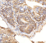 Zebrafish Psmc1 Antibody Colon Tissue IHC. Immunohistochemistry staining of FFPE zebrafish colon tissue with Psmc1 antibody, HRP-labeled secondary and DAB substrate. HIER: boil tissue sections in pH8 EDTA for 20 min and allow to cool before testing.