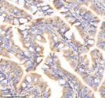 Zebrafish Psmc2 Antibody Colon Tissue IHC. Immunohistochemistry staining of FFPE zebrafish colon tissue with Psmc2 antibody, HRP-labeled secondary and DAB substrate. HIER: boil tissue sections in pH8 EDTA for 20 min and allow to cool before testing.