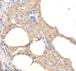 Zebrafish Psmc2 Antibody Pancreas Tissue IHC. Immunohistochemistry staining of FFPE zebrafish pancreas tissue with Psmc2 antibody, HRP-labeled secondary and DAB substrate. HIER: boil tissue sections in pH8 EDTA for 20 min and allow to cool before testing.