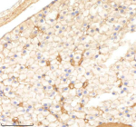 Zebrafish Psmc2 Antibody Liver Tissue IHC. Immunohistochemistry staining of FFPE zebrafish liver tissue with Psmc2 antibody, HRP-labeled secondary and DAB substrate. HIER: boil tissue sections in pH8 EDTA for 20 min and allow to cool before testing.