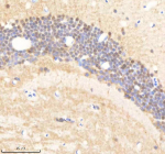 Zebrafish Psmc5 Antibody Brain Tissue IHC. Immunohistochemistry staining of zebrafish Psmc5 protein using Zebrafish Psmc5 antibody, HRP-labeled secondary and DAB substrate. Psmc5 was detected in a paraffin-embedded section of zebrafish brain tissue. HIER: boil tissue sections in pH8 EDTA for 20 min and allow to cool before testing.