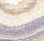 Zebrafish Psmc5 Antibody Eye Tissue IHC. Immunohistochemistry staining of zebrafish Psmc5 protein using Zebrafish Psmc5 antibody, HRP-labeled secondary and DAB substrate. Psmc5 was detected in a paraffin-embedded section of zebrafish eye tissue. HIER: boil tissue sections in pH8 EDTA for 20 min and allow to cool before testing.