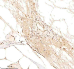 Zebrafish Psmc5 Antibody Spinal Tissue IHC. Immunohistochemistry staining of zebrafish Psmc5 protein using Zebrafish Psmc5 antibody, HRP-labeled secondary and DAB substrate. Psmc5 was detected in a paraffin-embedded section of zebrafish spinal tissue. HIER: boil tissue sections in pH8 EDTA for 20 min and allow to cool before testing.