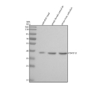 Zebrafish Psmd13 Antibody Tissue WB. Western blot analysis of Psmd13 protein using Zebrafish Psmd13 antibody and 1) zebrafish head, 2) whole female zebrafish and 3) whole male zebrafish tissue lysate. Predicted molecular weight ~43 kDa.