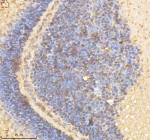 Zebrafish Psmd2 Antibody Eye Tissue IHC. Immunohistochemistry staining of FFPE zebrafish eye tissue with Psmd2 antibody, HRP-labeled secondary and DAB substrate. HIER: boil tissue sections in pH8 EDTA for 20 min and allow to cool before testing.(Resolving gel) for 2 hours. Lane 1: zebrafish head tissue lysates,