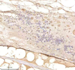 Zebrafish Psmd8 Antibody Spinal Tissue IHC. Immunohistochemistry staining of zebrafish Psmd8 protein using Zebrafish Psmd8 antibody, HRP-labeled secondary and DAB substrate. Psmd8 was detected in a paraffin-embedded section of zebrafish spinal tissue. HIER: boil tissue sections in pH8 EDTA for 20 min and allow to cool before testing.