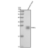 Zebrafish Rab4a Antibody Head Tissue WB. Western blot analysis of Rab4a protein using Zebrafish Rab4a antibody and zebrafish head tissue lysates. Predicted molecular weight ~24 kDa.