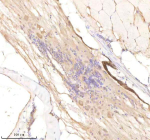 Zebrafish Rcc2 Antibody Spinal Tissue IHC. Immunohistochemistry staining of FFPE zebrafish spinal cord tissue with Rcc2 antibody, HRP-labeled secondary and DAB substrate. HIER: boil tissue sections in pH8 EDTA for 20 min and allow to cool before testing.
