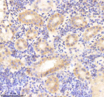 Zebrafish Rcc2 Antibody Kidney Tissue IHC. Immunohistochemistry IHC staining of FFPE zebrafish kidney tissue with Rcc2 antibody, HRP-labeled secondary and DAB substrate. HIER: boil tissue sections in pH8 EDTA for 20 min and allow to cool before testing.