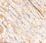 Zebrafish Rcc2 Antibody Muscle Tissue IHC. Immunohistochemistry staining of FFPE zebrafish muscle tissue with Rcc2 antibody, HRP-labeled secondary and DAB substrate. HIER: boil tissue sections in pH8 EDTA for 20 min and allow to cool before testing.