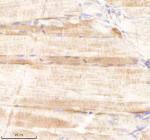 Zebrafish Sars1 Antibody Muscle Tissue IHC. Immunohistochemistry staining of FFPE zebrafish muscle tissue with Sars1 antibody, HRP-labeled secondary and DAB substrate. HIER: boil tissue sections in pH8 EDTA for 20 min and allow to cool before testing.