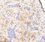 Zebrafish Sf3b3 Antibody Heart Tissue IHC. Immunohistochemistry staining of zebrafish Sf3b3 protein using Zebrafish Sf3b3 antibody, HRP-labeled secondary and DAB substrate. Sf3b3 was detected in a paraffin-embedded section of zebrafish heart tissue. HIER: boil tissue sections in pH8 EDTA for 20 min and allow to cool before testing.