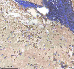 Zebrafish Shha antibody brain tissue IHC. Immunohistochemistry staining of Sonic Hedgehog protein in FFPE zebrafish brain tissue with Shha antibody, HRP-labeled secondary and DAB substrate. HIER: boil tissue sections in pH8 EDTA for 20 min and allow to cool before testing.