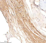Zebrafish Smarca4a Antibody Spinal Cord Tissue IHC. Immunohistochemistry staining of zebrafish Smarca4 protein using Zebrafish Smarca4a antibody, HRP-labeled secondary and DAB substrate. Smarca4a was detected in a paraffin-embedded section of zebrafish spinal cord tissue. HIER: boil tissue sections in pH8 EDTA for 20 min and allow to cool before testing.