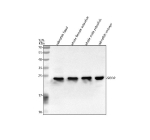 Zebrafish Sod2 Antibody Tissue WB. Western blot analysis of Superoxide dismutase 2 protein using Zebrafish Sod2 antibody and 1) zebrafish head, 2) whole female zebrafish, 3) whole male zebrafish and 4) zebrafish embryo tissue lysate. Predicted molecular weight ~25 kDa.