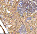 Zebrafish Srebf1 Antibody Heart Tissue IHC. Immunohistochemistry staining of zebrafish Srebf1 protein using Zebrafish Srebf1 antibody, HRP-labeled secondary and DAB substrate. Srebf1 was detected in a paraffin-embedded section of zebrafish heart tissue. HIER: boil tissue sections in pH8 EDTA for 20 min and allow to cool before testing.