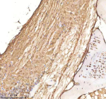 Zebrafish Cdc48 Antibody Spinal Cord Tissue IHC. Immunohistochemistry staining of FFPE zebrafish spinal cord tissue with Cdc48 antibody, HRP-labeled secondary and DAB substrate. HIER: boil tissue sections in pH8 EDTA for 20 min and allow to cool before testing.