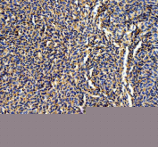 Zebrafish Abcc12 Antibody Liver Tissue IHC. Immunohistochemistry staining of FFPE zebrafish liver tissue with Abcc12 antibody, HRP-labeled secondary and DAB substrate. HIER: boil tissue sections in pH8 EDTA for 20 min and allow to cool before testing.