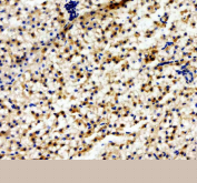 Zebrafish Abcc12 Antibody Colon Tissue IHC. Immunohistochemistry IHC staining of FFPE zebrafish colon tissue with Abcc12 antibody, HRP-labeled secondary and DAB substrate. HIER: boil tissue sections in pH8 EDTA for 20 min and allow to cool before testing.
