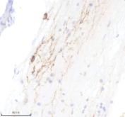 Zebrafish TPH2 Antibody Serotonergic Spinal Cord IHC. Immunohistochemistry staining of FFPE zebrafish spinal cord tissue using Zebrafish TPH2 Antibody demonstrates distinct cytoplasmic and neurite-associated HRP-DAB brown staining within scattered neural cell populations and elongated neuronal processes. The staining pattern is consistent with expression of Tryptophan Hydroxylase 2 (TPH2), the rate-limiting enzyme in serotonin biosynthesis and a well-established marker of serotonergic neurons. Signal is observed within neural structures associated with serotonergic neurotransmission, reflecting the role of TPH2 in regulating serotonin production and nervous system function. Heat mediated antigen retrieval was performed in EDTA buffer. Primary antibody was incubated overnight at 4Â°C followed by detection using a peroxidase-conjugated goat anti-rabbit secondary antibody and DAB chromogen.