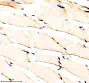 Zebrafish IGF1 Receptor / IGF1RA Antibody Muscle IHC. Immunohistochemistry staining of FFPE zebrafish muscle tissue using Zebrafish IGF1 Receptor Antibody demonstrates diffuse cytoplasmic HRP-DAB brown staining throughout elongated skeletal muscle fibers. The staining pattern is consistent with expression of Insulin-Like Growth Factor 1 Receptor Alpha (IGF1RA), a receptor tyrosine kinase that mediates growth factor signaling involved in cellular proliferation, differentiation, metabolism, and muscle development. Signal is observed within myofiber-associated cellular compartments, reflecting the established role of IGF signaling in skeletal muscle growth, maintenance, and tissue homeostasis. Heat mediated antigen retrieval was performed in EDTA buffer. Primary antibody was incubated overnight at 4Â°C followed by detection using a peroxidase-conjugated goat anti-rabbit secondary antibody and DAB chromogen.