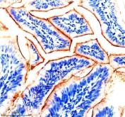 Zebrafish IGF1 Receptor / IGF1RA Antibody Colon IHC. Immunohistochemistry staining of FFPE zebrafish colon tissue using Zebrafish IGF1 Receptor Antibody demonstrates prominent membranous and cytoplasmic HRP-DAB brown staining within glandular epithelial cell populations lining the intestinal mucosa. The staining pattern is consistent with expression of Insulin-Like Growth Factor 1 Receptor Alpha (IGF1RA), a receptor tyrosine kinase that regulates growth factor signaling involved in cellular proliferation, differentiation, survival, and tissue homeostasis. Strong epithelial-associated staining is consistent with the established role of IGF signaling in gastrointestinal development, epithelial maintenance, and regulation of intestinal growth. Heat mediated antigen retrieval was performed in EDTA buffer. Primary antibody was incubated overnight at 4Â°C followed by detection using a peroxidase-conjugated goat anti-rabbit secondary antibody and DAB chromogen.
