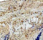 Zebrafish CYP11C1 / 11B-Hydroxylase Antibody Brain IHC. Immunohistochemistry staining of FFPE zebrafish brain tissue using Zebrafish CYP11C1 Antibody demonstrates cytoplasmic HRP-DAB brown staining within scattered neural and perivascular-associated cellular populations. The staining pattern is consistent with expression of Cytochrome P450 Family 11 Subfamily C Member 1 (CYP11C1), also known as 11B-Hydroxylase, a steroidogenic enzyme that catalyzes key steps in cortisol biosynthesis and glucocorticoid production. Signal is observed within brain-associated tissue compartments, reflecting the established relationship between corticosteroid signaling pathways, neuroendocrine regulation, and stress-responsive physiological processes. Heat mediated antigen retrieval was performed in EDTA buffer. Primary antibody was incubated overnight at 4Â°C followed by detection using a peroxidase-conjugated goat anti-rabbit secondary antibody and DAB chromogen.