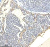 Zebrafish Titin Antibody IHC. Immunohistochemistry analysis of TTN using anti-TTN antibody. TTN was detected in a paraffin-embedded section of zebrafish heart tissue. Heat mediated antigen retrieval was performed in EDTA buffer. The tissue section was blocked with 10% goat serum. The tissue section was then incubated with 2 ug/ml rabbit anti-TTN Antibody overnight at 4oC. Peroxidase Conjugated Goat Anti-rabbit IgG was used as secondary antibody and incubated for 30 minutes at 37oC. The tissue section was developed using DAB as the chromogen.