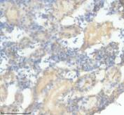 Zebrafish IFNPHI3 Antibody IHC. Immunohistochemistry analysis of IFNPHI3 using anti-IFNPHI3 antibody. IFNPHI3 was detected in a paraffin-embedded section of zebrafish kidney tissue. Heat mediated antigen retrieval was performed in EDTA buffer. The tissue section was blocked with 10% goat serum. The tissue section was then incubated with 2 ug/ml rabbit anti-IFNPHI3 Antibody overnight at 4oC. Peroxidase Conjugated Goat Anti-rabbit IgG was used as secondary antibody and incubated for 30 minutes at 37oC. The tissue section was developed using DAB as the chromogen.