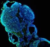 Zebrafish CYP1B1 Antibody IF. Immunofluorescence analysis of CYP1B1 using anti-CYP1B1 antibody. CYP1B1 was detected in a paraffin-embedded section of zebrafish embryo tissue. Heat mediated antigen retrieval was performed in EDTA buffer. The tissue section was blocked with 10% goat serum. The tissue section was then incubated with 5 ug/ml rabbit anti-CYP1B1 Antibody overnight at 4oC. DyLight-488 Conjugated Goat Anti-Rabbit IgG was used as secondary antibody at 1:500 dilution and incubated for 30 minutes at 37oC. The section was counterstained with DAPI. Visualize using a fluorescence microscope and filter sets appropriate for the label used.