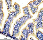 Zebrafish CYP1B1 Antibody IHC. Immunohistochemistry analysis of CYP1B1 using anti-CYP1B1 antibody. CYP1B1 was detected in a paraffin-embedded section of zebrafish colon tissue. Heat mediated antigen retrieval was performed in EDTA buffer. The tissue section was blocked with 10% goat serum. The tissue section was then incubated with 2 ug/ml rabbit anti-CYP1B1 Antibody overnight at 4oC. Peroxidase Conjugated Goat Anti-rabbit IgG was used as secondary antibody and incubated for 30 minutes at 37oC. The tissue section was developed using DAB as the chromogen.