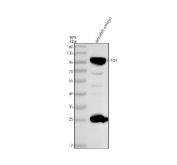 Zebrafish Progesterone Receptor Antibody WB. Western blot analysis of PGR using anti-PGR antibody. Electrophoresis was performed on a 10% SDS-PAGE gel for 2 hours. The sample well of each lane was loaded with 30 ug of sample under reducing conditions. Lane 1: zebrafish embryo tissue lysates. After electrophoresis, proteins were transferred to a nitrocellulose membrane at 150 mA for 50-90 minutes. Blocked the membrane with 5% non-fat milk/TBS for 1.5 hour at RT. The membrane was incubated with rabbit anti-PGR antigen antibody at 0.5 ug/ml overnight at 4oC, then washed with TBS-0.1%Tween 3 times with 5 minutes each and probed with a goat anti-rabbit IgG-HRP secondary antibody at a dilution of 1:5000 for 1.5 hour at RT. The signal is developed using an ECL Plus WB. Western blotting Substrate with Tanon 5200 system. A specific band was detected for PGR at approximately 100 kDa. The expected band size for PGR is at 36 kDa.