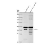 Zebrafish IkB Alpha / NFKBIAA Antibody NF-kB Signaling WB. Western blot analysis of zebrafish head tissue and whole female zebrafish lysates using Zebrafish IkB Alpha Antibody demonstrates a prominent immunoreactive band at approximately 35 kDa, consistent with the predicted molecular weight of Nuclear Factor of Kappa Light Polypeptide Gene Enhancer in B-Cells Inhibitor Alpha A (NFKBIAA), also known as IkB Alpha. Additional lower and higher molecular weight immunoreactive bands are observed and may represent modified forms, degradation products, or other antibody-reactive species. NFKBIAA is a key negative regulator of NF-kB signaling that controls inflammatory, immune, and cellular stress-response pathways through sequestration of NF-kB transcription factors in the cytoplasm. Electrophoresis was performed on a 10% SDS-PAGE gel under reducing conditions followed by transfer to a nitrocellulose membrane. Signal was detected using an HRP-conjugated secondary antibody and enhanced chemiluminescent substrate.