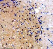 Zebrafish FOXJ1 / FOXJ1A Antibody Brain IHC. Immunohistochemistry staining of FFPE zebrafish brain tissue using Zebrafish FOXJ1 Antibody demonstrates nuclear-predominant HRP-DAB brown staining within scattered neural-associated cellular populations. The staining pattern is consistent with expression of Forkhead Box J1A (FOXJ1A), a transcription factor that serves as a master regulator of motile ciliogenesis and ciliated cell differentiation. Signal is observed within brain-associated tissue compartments, reflecting the established role of FOXJ1A in regulating cilia-related gene expression, neural development, and maintenance of specialized cell populations within the vertebrate nervous system. Heat mediated antigen retrieval was performed in EDTA buffer. Primary antibody was incubated overnight at 4Â°C followed by detection using a peroxidase-conjugated goat anti-rabbit secondary antibody and DAB chromogen.
