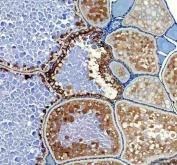 Zebrafish HSD17B1 / 17B-HSD1 Antibody Ovary IHC. Immunohistochemistry staining of FFPE zebrafish ovary tissue using Zebrafish HSD17B1 Antibody demonstrates strong cytoplasmic HRP-DAB brown staining within ovarian follicular and oocyte-associated cellular populations. The staining pattern is consistent with expression of Hydroxysteroid 17-Beta Dehydrogenase 1 (HSD17B1), also known as 17B-HSD1, a key steroidogenic enzyme that catalyzes the conversion of estrone to biologically active estradiol. Prominent staining within ovarian tissue is consistent with the established role of HSD17B1 in estrogen biosynthesis, reproductive physiology, gonadal development, and endocrine regulation. Heat mediated antigen retrieval was performed in EDTA buffer. Primary antibody was incubated overnight at 4Â°C followed by detection using a peroxidase-conjugated goat anti-rabbit secondary antibody and DAB chromogen.
