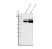 Zebrafish Delta-Like Protein B / DLB Antibody Notch Signaling WB. Western blot analysis of whole female and whole male zebrafish lysates using Zebrafish Delta-Like Protein B Antibody demonstrates a prominent immunoreactive band at approximately 67 kDa, consistent with the predicted molecular weight of Delta-Like Protein B (DLB). DLB is a membrane-associated ligand of the Notch signaling pathway that regulates cell fate determination, embryonic patterning, neurogenesis, and tissue development through cell-cell signaling interactions. The observed expression in both female and male zebrafish tissues is consistent with the established role of Delta family proteins in developmental signaling and maintenance of tissue homeostasis. The strong band detected at the expected molecular weight supports specific recognition of DLB in zebrafish tissue lysates. Electrophoresis was performed on a 10% SDS-PAGE gel under reducing conditions followed by transfer to a nitrocellulose membrane. Signal was detected using an HRP-conjugated secondary antibody and enhanced chemiluminescent substrate.