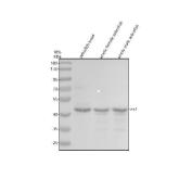 Zebrafish ZIC1 / Zinc Finger Protein of the Cerebellum 1 Antibody Neurodevelopment WB. Western blot analysis of zebrafish head tissue, whole female zebrafish, and whole male zebrafish lysates using Zebrafish ZIC1 Antibody demonstrates a prominent immunoreactive band at approximately 45 kDa, consistent with the predicted molecular weight of Zinc Finger Protein of the Cerebellum 1 (ZIC1). ZIC1 is a zinc finger transcription factor that functions as a key regulator of neurogenesis, neural patterning, cerebellar development, and embryonic tissue specification. The observed expression across multiple zebrafish tissue preparations is consistent with the broad developmental role of ZIC1 in regulating gene expression programs that govern nervous system formation and vertebrate embryogenesis. Minor lower molecular weight immunoreactive bands are also present and may represent degradation products, alternatively processed species, or non-specific antibody-reactive proteins. Electrophoresis was performed on a 10% SDS-PAGE gel under reducing conditions followed by transfer to a nitrocellulose membrane. Signal was detected using an HRP-conjugated secondary antibody and enhanced chemiluminescent substrate.
