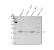 Zebrafish Cyclin E1 / CCNE1 Antibody Cell Cycle WB. Western blot analysis of zebrafish head tissue, whole female zebrafish, whole male zebrafish, and zebrafish embryo lysates using Zebrafish Cyclin E1 Antibody demonstrates a prominent immunoreactive band at approximately 46 kDa, consistent with the predicted molecular weight of Cyclin E1 (CCNE1). Cyclin E1 is a key regulator of G1/S cell cycle progression that functions through activation of CDK2 to promote DNA replication and cellular proliferation. The observed expression across multiple zebrafish tissue preparations, including embryonic tissue, is consistent with the established role of CCNE1 in developmental growth, tissue expansion, and regulation of cell cycle progression. Minor higher molecular weight immunoreactive bands are present in some samples and may represent post-translationally modified forms, protein complexes, or other antibody-reactive species. Electrophoresis was performed on a 10% SDS-PAGE gel under reducing conditions followed by transfer to a nitrocellulose membrane. Signal was detected using an HRP-conjugated secondary antibody and enhanced chemiluminescent substrate.