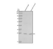 Zebrafish Goosecoid / GSC Antibody Developmental Transcription Factor WB. Western blot analysis of zebrafish head tissue and zebrafish embryo lysates using Zebrafish Goosecoid Antibody demonstrates a distinct immunoreactive band at approximately 25 kDa, consistent with the predicted molecular weight of Homeobox Protein Goosecoid (GSC). Goosecoid is a homeobox transcription factor that functions as a key regulator of embryonic patterning, gastrulation, mesoderm specification, and organizer activity during early vertebrate development. Detection of GSC in zebrafish embryo lysate is consistent with its established role in developmental signaling pathways that govern body axis formation and tissue specification. The observed band closely matches the expected molecular weight and supports specific recognition of Goosecoid in zebrafish tissues. Electrophoresis was performed on a 10% SDS-PAGE gel under reducing conditions followed by transfer to a nitrocellulose membrane. Signal was detected using an HRP-conjugated secondary antibody and enhanced chemiluminescent substrate.