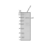 Zebrafish AXIN1 / Axis Inhibition Protein 1 Antibody Wnt Signaling WB. Western blot analysis of zebrafish head tissue lysate using Zebrafish AXIN1 Antibody demonstrates a prominent immunoreactive band at approximately 94 kDa, consistent with the predicted molecular weight of Axis Inhibition Protein 1 (AXIN1). AXIN1 is a scaffold protein that serves as a central regulator of the Wnt/beta-catenin signaling pathway by coordinating assembly of the beta-catenin destruction complex and controlling downstream developmental signaling events. Expression in zebrafish head tissue is consistent with the established role of AXIN1 in embryonic patterning, neural development, tissue specification, and regulation of cellular differentiation. The observed band closely matches the expected molecular weight and supports specific recognition of AXIN1 in zebrafish tissue lysates. Electrophoresis was performed on a 10% SDS-PAGE gel under reducing conditions followed by transfer to a nitrocellulose membrane. Signal was detected using an HRP-conjugated secondary antibody and enhanced chemiluminescent substrate.