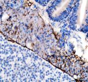 Zebrafish Vitellogenin 2 / VTG2 Antibody Pancreas IHC. Immunohistochemistry staining of FFPE zebrafish pancreas tissue using Zebrafish Vitellogenin 2 Antibody demonstrates distinct membranous and cytoplasmic HRP-DAB brown staining within clustered pancreatic epithelial cell populations. The staining pattern is consistent with expression of Vitellogenin 2 (VTG2), a large lipid-binding yolk precursor protein involved in nutrient transport, reproductive physiology, and estrogen-responsive signaling pathways. The observed immunoreactivity highlights discrete cellular populations within the pancreatic tissue and is consistent with the broad physiological functions of vitellogenin family proteins in vertebrate metabolism, nutrient mobilization, and developmental biology. Heat mediated antigen retrieval was performed in EDTA buffer. Primary antibody was incubated overnight at 4Â°C followed by detection using a peroxidase-conjugated goat anti-rabbit secondary antibody and DAB chromogen.