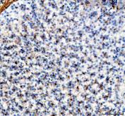 Zebrafish Vitellogenin 2 / VTG2 Antibody Liver IHC. Immunohistochemistry staining of FFPE zebrafish liver tissue using Zebrafish Vitellogenin 2 Antibody demonstrates widespread granular cytoplasmic HRP-DAB brown staining throughout hepatocyte populations. The staining pattern is consistent with expression of Vitellogenin 2 (VTG2), a major yolk precursor protein synthesized primarily in the liver under estrogen-responsive regulation and subsequently transported to developing oocytes. Hepatic localization is consistent with the established biological role of vitellogenins in nutrient transport, reproductive physiology, embryonic nutrition, and endocrine-regulated metabolic processes. The widespread hepatocellular staining observed in this section supports the liver as a principal site of VTG2 production in zebrafish. Heat mediated antigen retrieval was performed in EDTA buffer. Primary antibody was incubated overnight at 4Â°C followed by detection using a peroxidase-conjugated goat anti-rabbit secondary antibody and DAB chromogen.