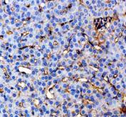 Zebrafish CYP3A65 Antibody Liver IHC. Immunohistochemistry staining of paraffin-embedded zebrafish liver tissue using Zebrafish CYP3A65 Antibody / Cytochrome P450 Enzyme Antibody demonstrates predominantly cytoplasmic HRP-DAB brown staining throughout hepatocyte populations. The staining pattern is consistent with expression of Cytochrome P450 3A65 (CYP3A65), a member of the cytochrome P450 enzyme family involved in xenobiotic metabolism, detoxification, and oxidative biotransformation of endogenous and exogenous compounds. Hepatic localization is consistent with the established role of CYP3A family enzymes in drug metabolism and chemical processing within the liver. The observed staining highlights metabolically active hepatocytes and supports the use of CYP3A65 as a marker for studies of toxicology, pharmacology, metabolic regulation, and environmental response pathways in zebrafish. Heat-mediated antigen retrieval was performed in pH 8.0 EDTA buffer prior to staining.
