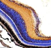 Zebrafish CYP3A65 Antibody Eye IHC. Immunohistochemistry staining of paraffin-embedded zebrafish eye tissue using Zebrafish CYP3A65 Antibody / Cytochrome P450 Enzyme Antibody demonstrates strong cytoplasmic HRP-DAB brown staining within retinal cell layers, with prominent immunoreactivity extending across multiple neural and photoreceptor-associated regions of the retina. The staining pattern is consistent with expression of Cytochrome P450 3A65 (CYP3A65), a member of the cytochrome P450 enzyme family involved in xenobiotic metabolism, detoxification, and oxidative processing of endogenous signaling molecules. Retinal expression is consistent with a role for CYP3A65 in local metabolic regulation and protection of ocular tissues from endogenous and environmental compounds. The observed staining highlights the metabolically active nature of retinal cells and supports the use of CYP3A65 as a target for studies of ocular biology, toxicology, and cytochrome P450-mediated metabolic pathways in zebrafish. Heat-mediated antigen retrieval was performed in EDTA buffer prior to staining.