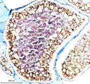 Zebrafish CYP3A65 Antibody Ovary IHC. Immunohistochemistry staining of paraffin-embedded zebrafish ovary tissue using Zebrafish CYP3A65 Antibody / Cytochrome P450 Enzyme Antibody demonstrates strong cytoplasmic and membranous HRP-DAB brown staining within ovarian follicular cells surrounding developing oocytes. The staining pattern is consistent with expression of Cytochrome P450 3A65 (CYP3A65), a member of the cytochrome P450 enzyme family involved in xenobiotic metabolism and oxidative processing of endogenous compounds. Ovarian localization is consistent with the role of cytochrome P450 enzymes in steroid metabolism, reproductive physiology, and regulation of hormone-associated signaling pathways. The prominent staining observed in follicle-associated cell populations highlights metabolically active compartments involved in oocyte development and reproductive function. These findings support the use of CYP3A65 as a target for studies of zebrafish reproductive biology, endocrine regulation, toxicology, and cytochrome P450-mediated metabolic pathways. Heat-mediated antigen retrieval was performed in EDTA buffer prior to staining.