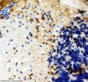 Zebrafish FGF20 Antibody Brain IHC. Immunohistochemistry staining of paraffin-embedded zebrafish brain tissue using Zebrafish FGF20 Antibody / FGF20A Antibody demonstrates cytoplasmic HRP-DAB brown staining within scattered neural cell populations and adjacent neuropil-rich regions. The staining pattern is consistent with expression of Fibroblast Growth Factor 20A (FGF20A), a secreted growth factor involved in developmental signaling, neural differentiation, cellular survival, and tissue regeneration. Expression within brain tissue is consistent with the established role of fibroblast growth factor family members in nervous system development and maintenance. The observed immunoreactivity supports the use of FGF20A as a marker for studies investigating neurodevelopment, regenerative signaling pathways, and growth factor-mediated cellular communication in zebrafish. Heat-mediated antigen retrieval was performed in EDTA buffer prior to staining.