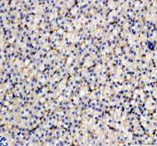 Zebrafish EpCAM Antibody Liver IHC. Immunohistochemistry staining of paraffin-embedded zebrafish liver tissue using Zebrafish EpCAM Antibody / CD326 Antibody demonstrates membranous and cytoplasmic HRP-DAB brown staining within hepatocyte populations and associated epithelial cell compartments. The staining pattern is consistent with expression of Epithelial Cell Adhesion Molecule (EPCAM/CD326), a transmembrane glycoprotein involved in epithelial cell adhesion, tissue organization, and regulation of cellular signaling pathways. Hepatic expression of EpCAM is consistent with its role in maintaining epithelial architecture and supporting cellular communication within organized tissue structures. The observed staining supports the use of EPCAM as a marker for studies investigating epithelial biology, tissue development, regenerative responses, and cell adhesion mechanisms in zebrafish. Heat-mediated antigen retrieval was performed in EDTA buffer prior to staining.